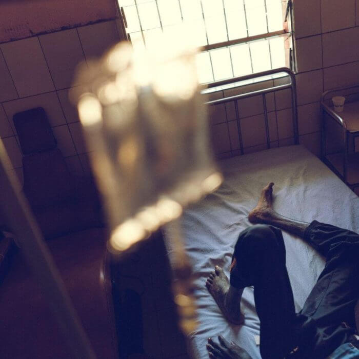A patient lying on a bed with a drip stand connected.